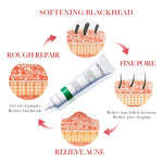 Load image into Gallery viewer, BIOAQUA Salicylic Acid Face Cream Acne Creams Mark Repair Firming Moisturizing Blackhead Remover skincare Facial Cream
