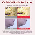 Load image into Gallery viewer, Korean Madeca Cream Centella Collagen Face Moisturizer Anti-Wrinkle Firming Barrier Repair Skin Care
